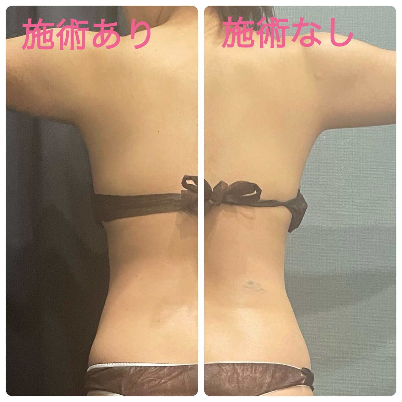 新BodyMenu☆～before after～