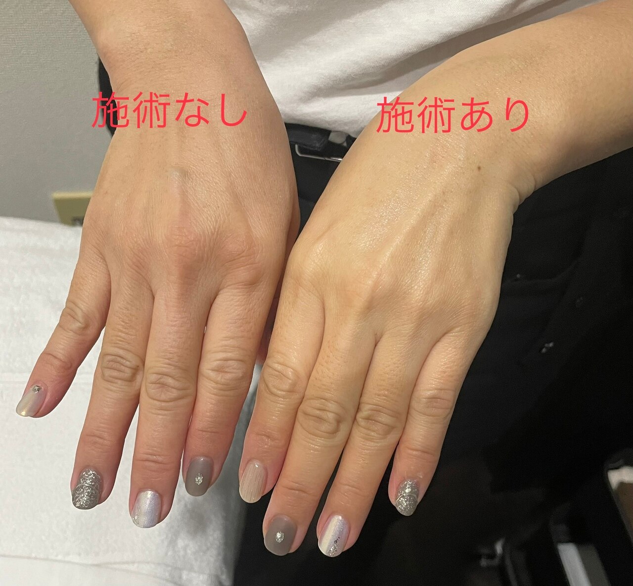 【年末年始キャンペーン】炭酸パックについて