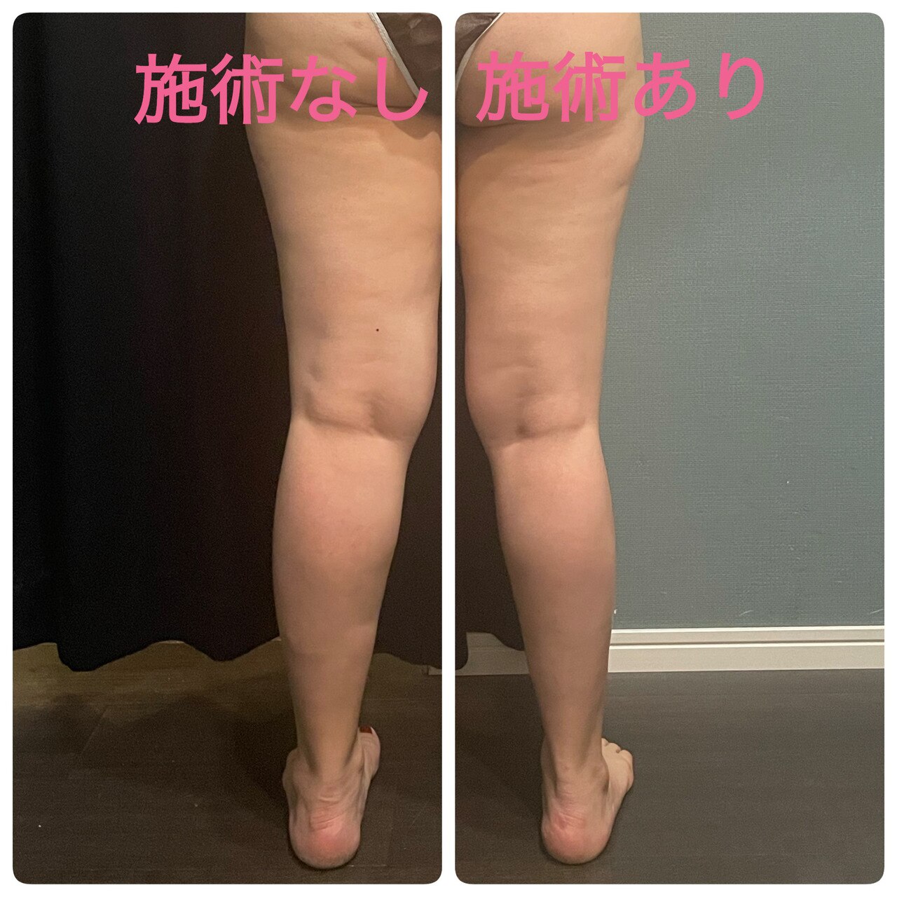 新BodyMenu☆～before after～